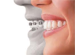 Tratamientos: Servicios de Clínica Dental Rident Tratamientos: Servicios de Clínica Dental Rident