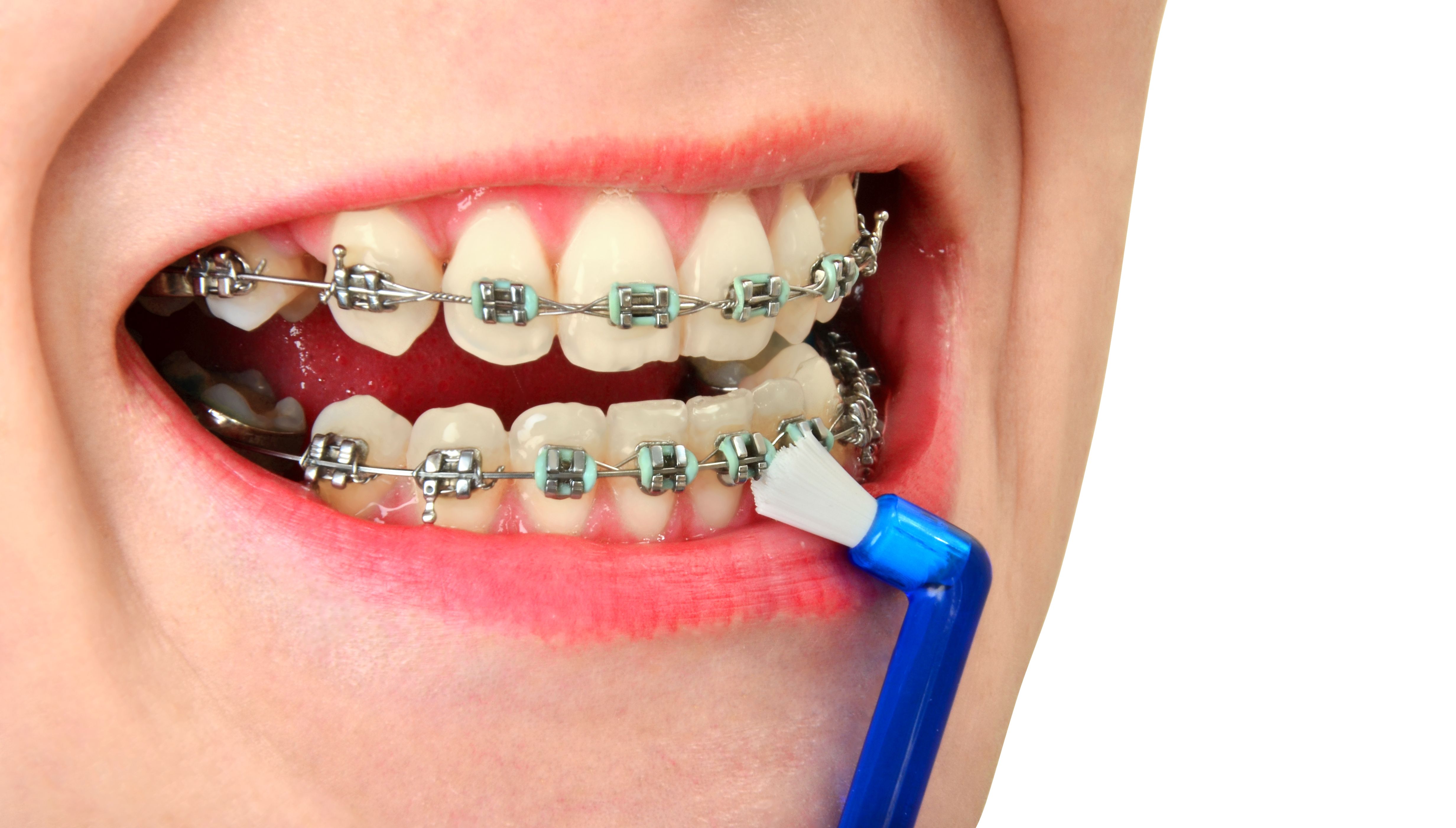 Odontopediatría: Especialidades de Clínica Dental Europa Odontopediatría: Especialidades de Clínica Dental Europa