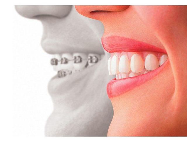 Ortodoncia: Especialidades de Centre Odontològic Idzi Ortodoncia: Especialidades de Centre Odontològic Idzi