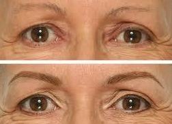 Micropigmentacion en cejas.: Servicios de Duo Stetica Micropigmentacion en cejas.: Servicios de Duo Stetica