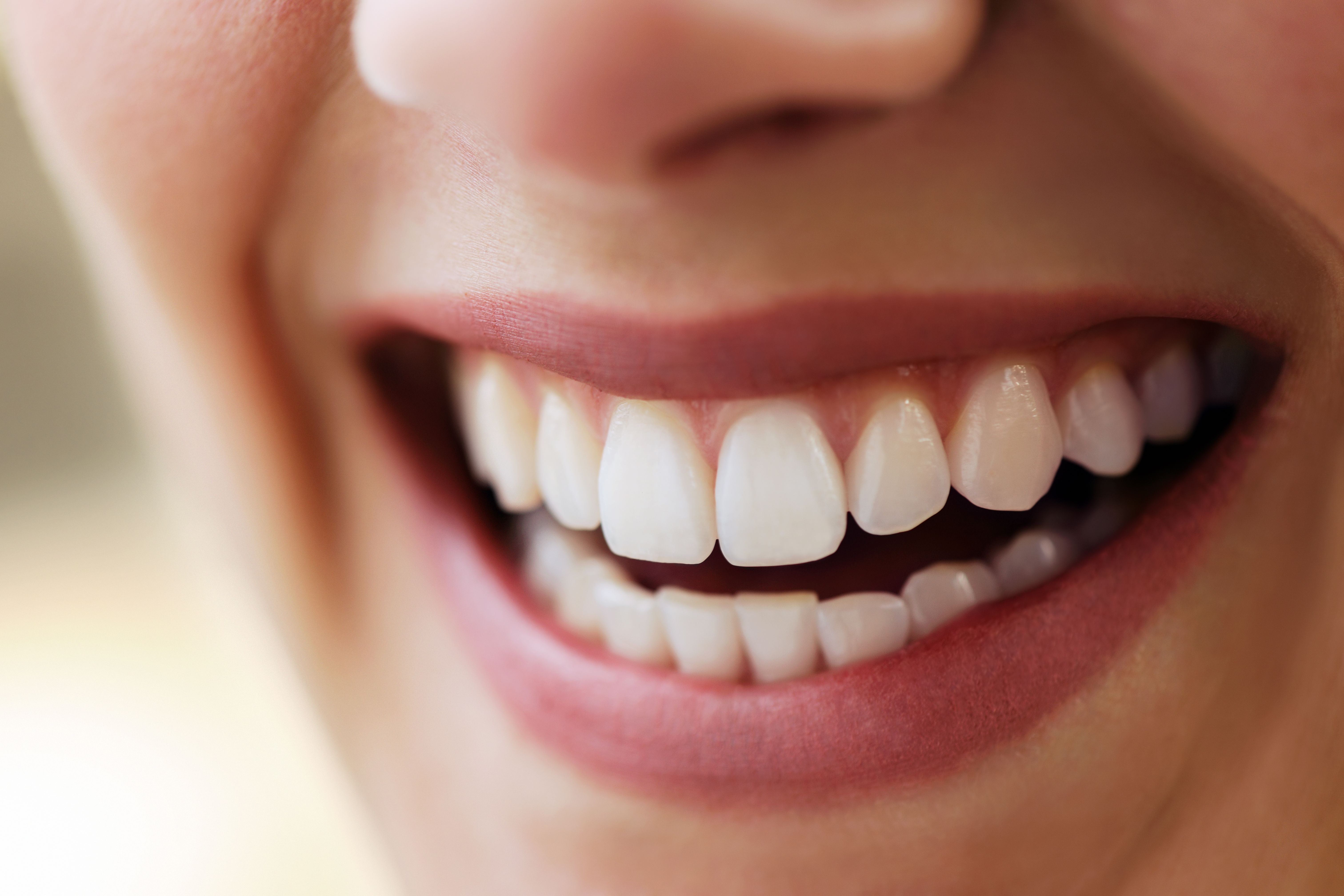 Blanqueamiento dental: Servicios de Centro de belleza Rojas Blanqueamiento dental: Servicios de Centro de belleza Rojas
