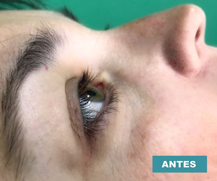 Pestañas: Servicios de Centro de belleza Rojas Pestañas: Servicios de Centro de belleza Rojas