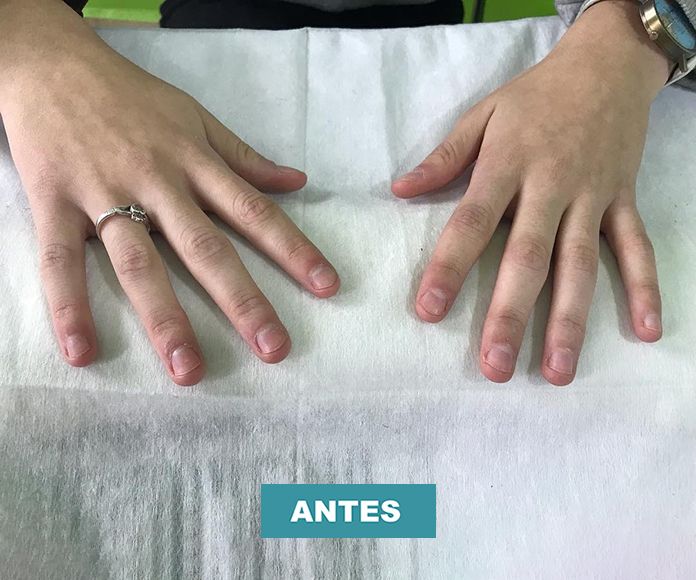 Uñas acrílicas: Servicios de Centro de belleza Rojas Uñas acrílicas: Servicios de Centro de belleza Rojas