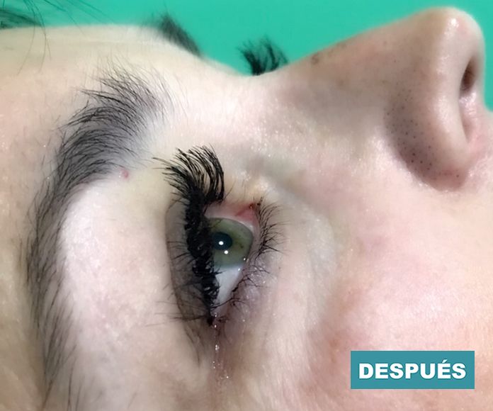 Pestañas: Servicios de Centro de belleza Rojas Pestañas: Servicios de Centro de belleza Rojas