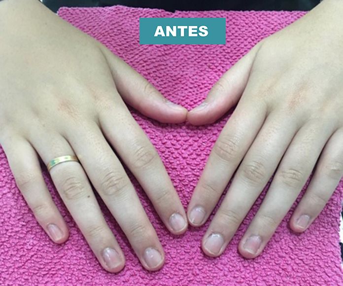 Uñas acrílicas: Servicios de Centro de belleza Rojas Uñas acrílicas: Servicios de Centro de belleza Rojas