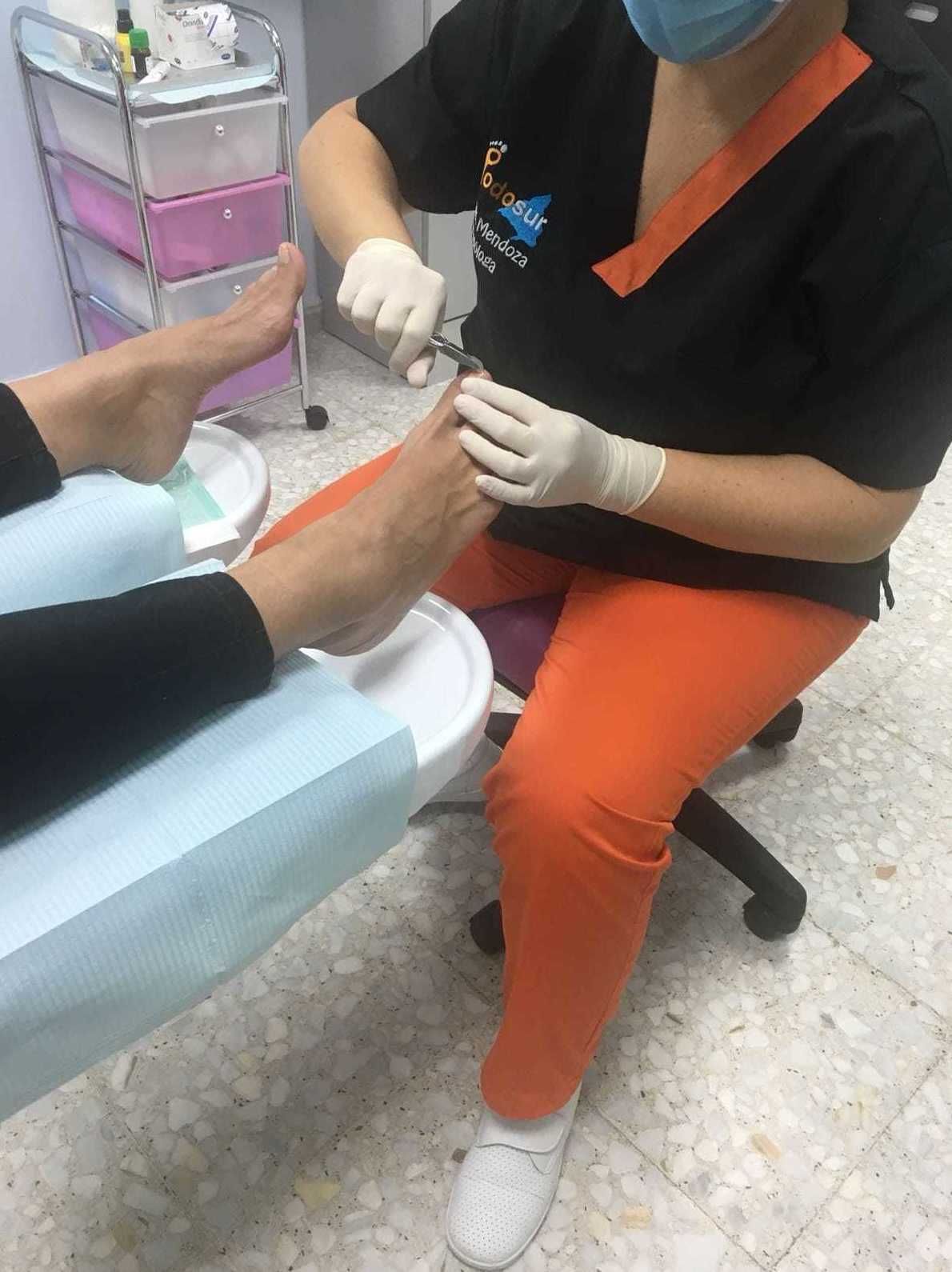 Uña encarnada: Productos y servicios de Podosur Uña encarnada: Productos y servicios de Podosur