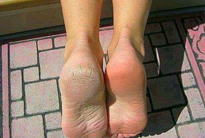 Cuidado integral del pie: Servicios de Alejandra Estética y Belleza Cuidado integral del pie: Servicios de Alejandra Estética y Belleza