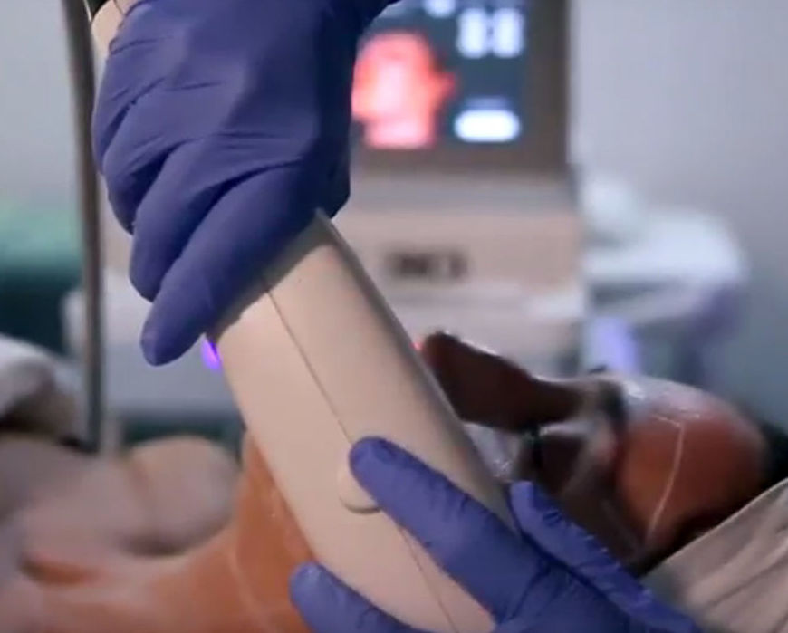 HIFU 3D: Servicios de Bodybrite Majadahonda HIFU 3D: Servicios de Bodybrite Majadahonda