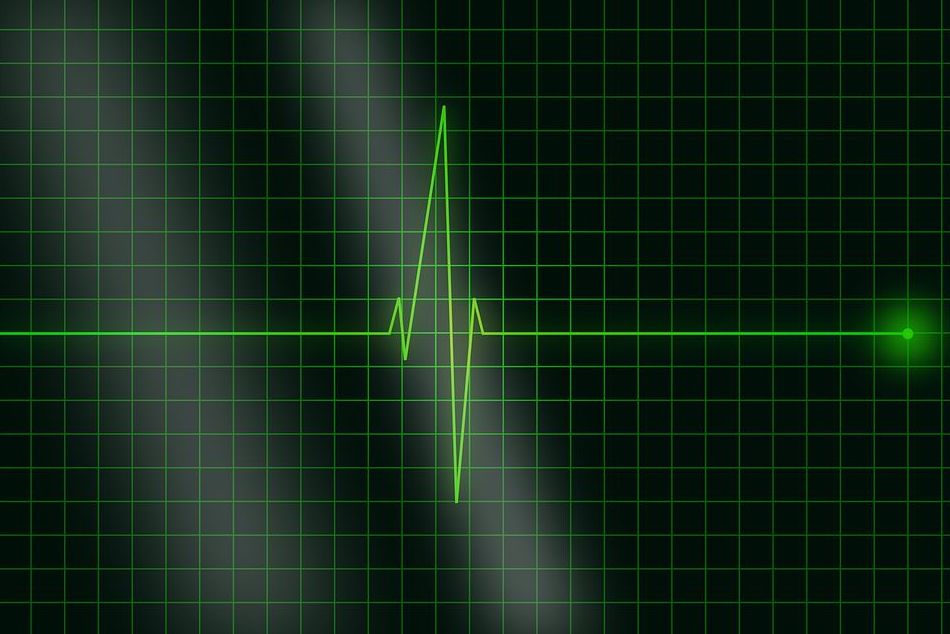 Electrocardiografía: Catálogo de Clínica Veterinaria Los Galgos 928 252685 - Peluquería Los Galgos 928 201156 Electrocardiografía: Catálogo de Clínica Veterinaria Los Galgos 928 252685 - Peluquería Los Galgos 928 201156