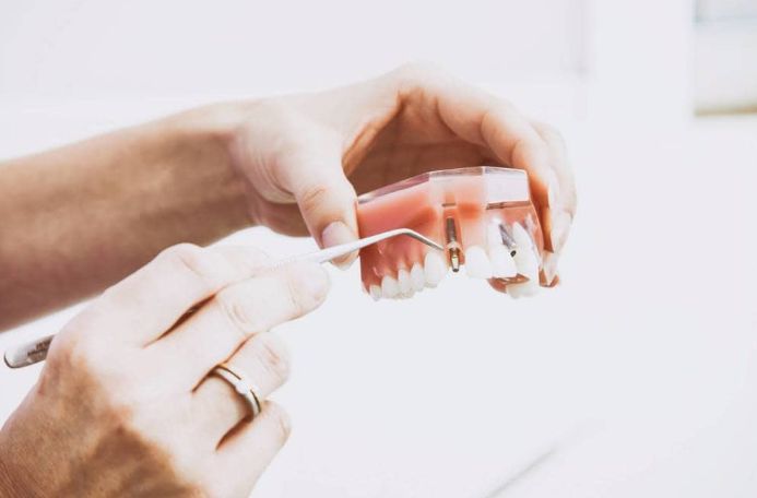 Endodoncias y prótesis: Tratamientos de M. José Cadiñanos Díaz Tejeiro, Dra. Endodoncias y prótesis: Tratamientos de M. José Cadiñanos Díaz Tejeiro, Dra.