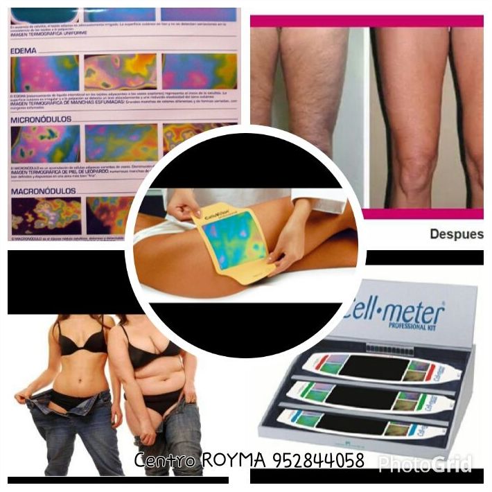 Perdida de peso: Tratamientos de belleza de Centro Bienestar y Salud Cayma Perdida de peso: Tratamientos de belleza de Centro Bienestar y Salud Cayma