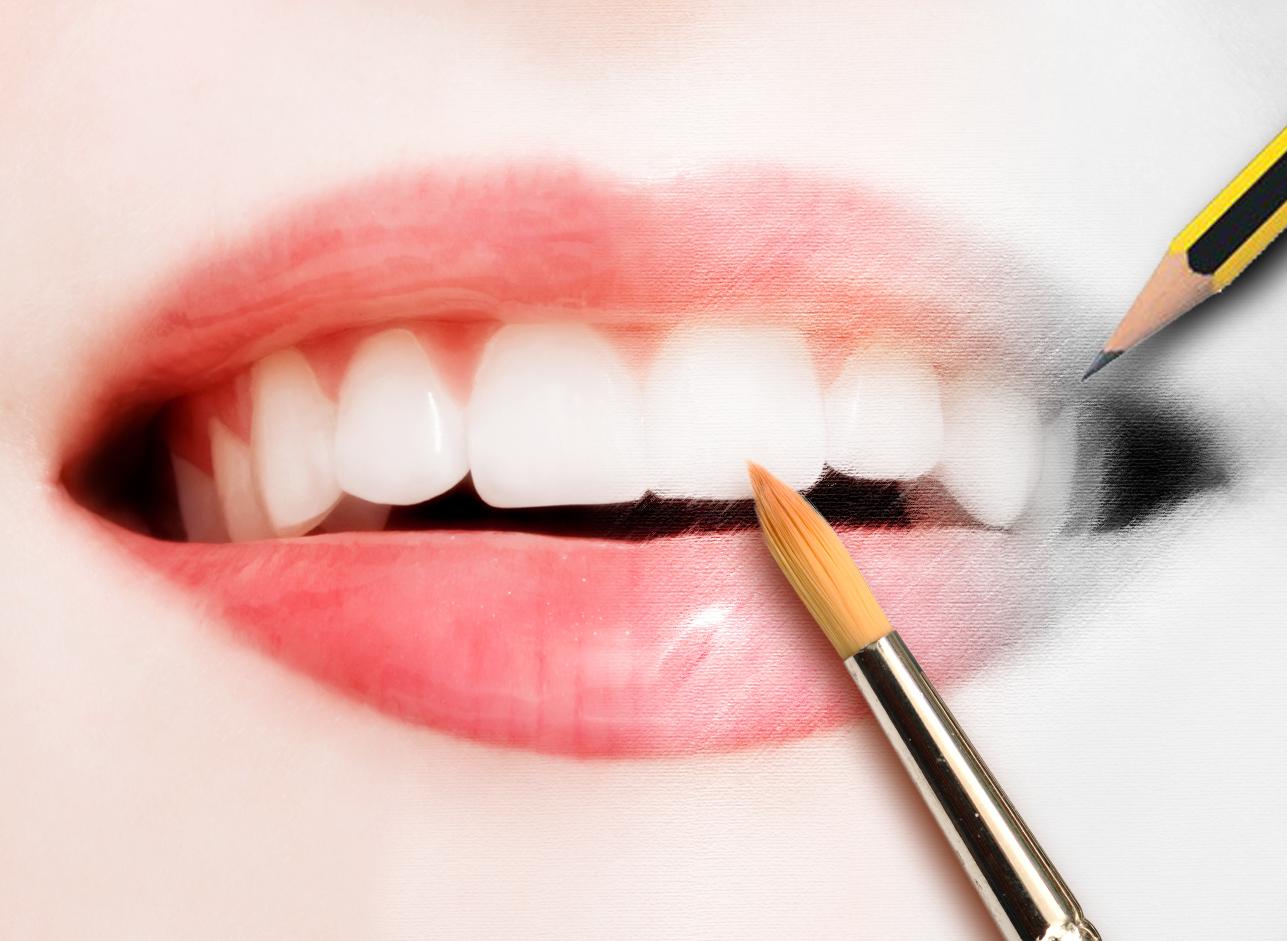 Estética dental Estética dental