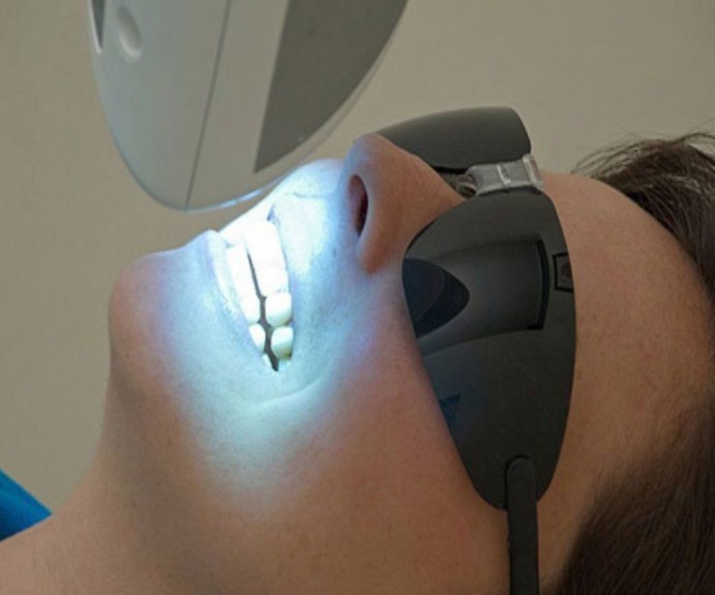 Blanqueamiento: Servicios de Clínica Dental Dr. Esteve Padrós Blanqueamiento: Servicios de Clínica Dental Dr. Esteve Padrós