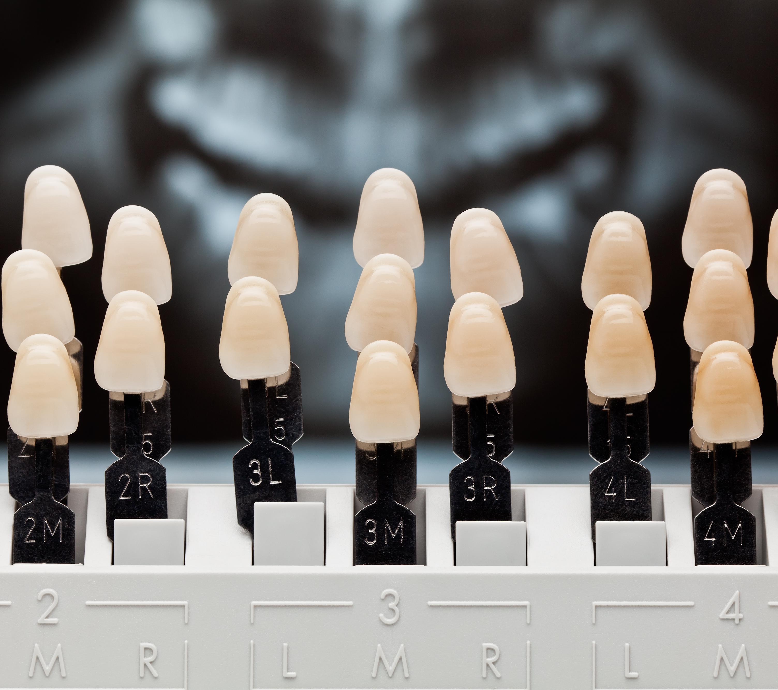 Estética dental Estética dental