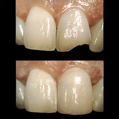 Estética dental Estética dental