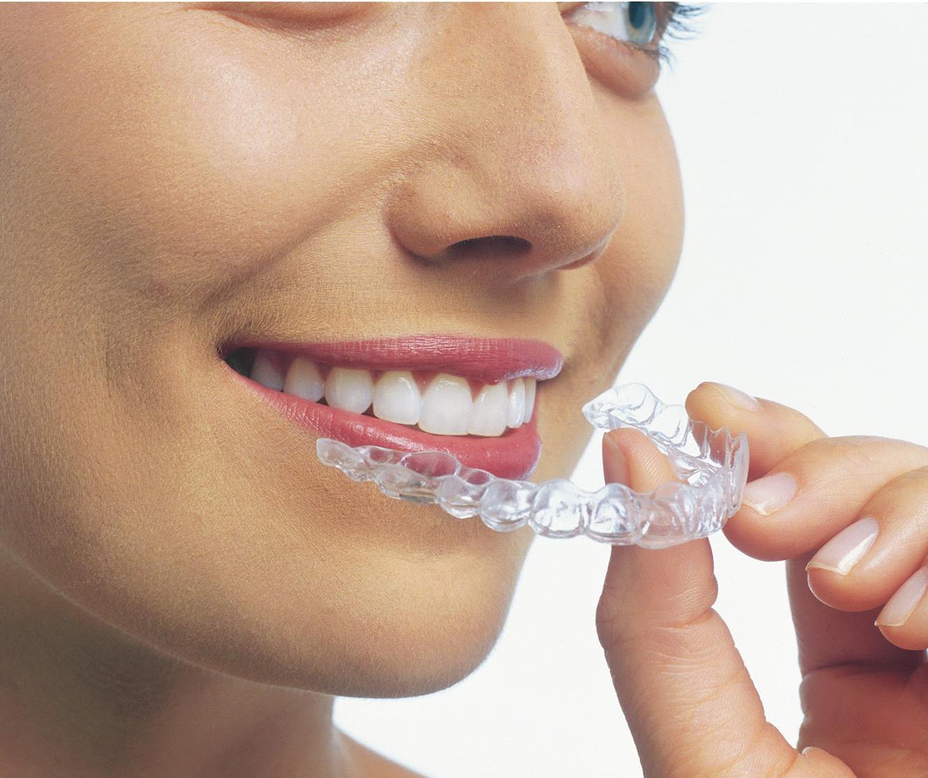 Ortodoncia invisible Invisalign Ortodoncia invisible Invisalign