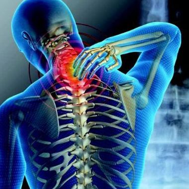 Cervicalgia Cervicalgia