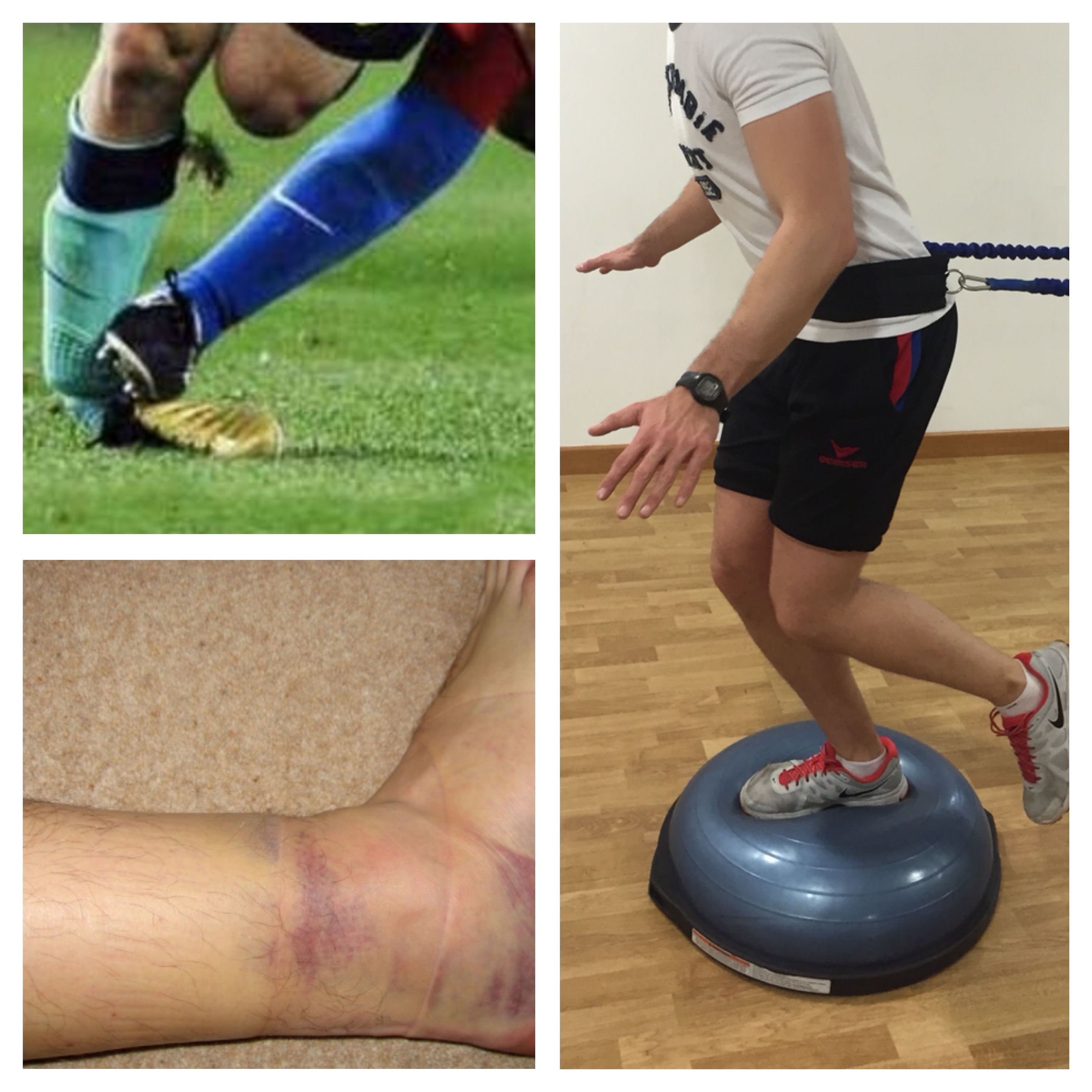 Tratamiento de esguince de tobillo: Especialidades de Clínica Fisioterapia Maccari Sport Tratamiento de esguince de tobillo: Especialidades de Clínica Fisioterapia Maccari Sport