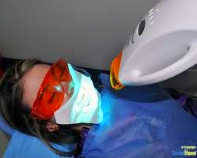Blanqueamiento dental: Tratamientos de Azul Salón De Belleza Blanqueamiento dental: Tratamientos de Azul Salón De Belleza
