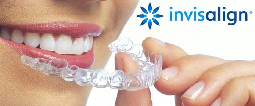 Invisalign 1 Invisalign 1