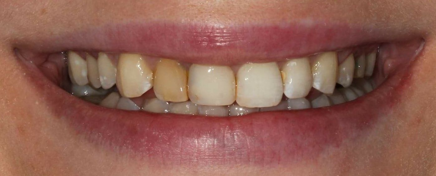 Foto 28 de Clínica dental en Madrid | Clínica Dental Dres. Nuñez García