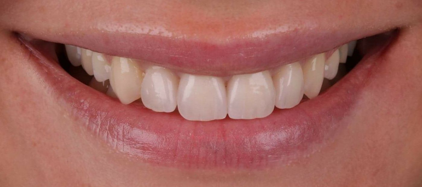Foto 30 de Clínica dental en Madrid | Clínica Dental Dres. Nuñez García