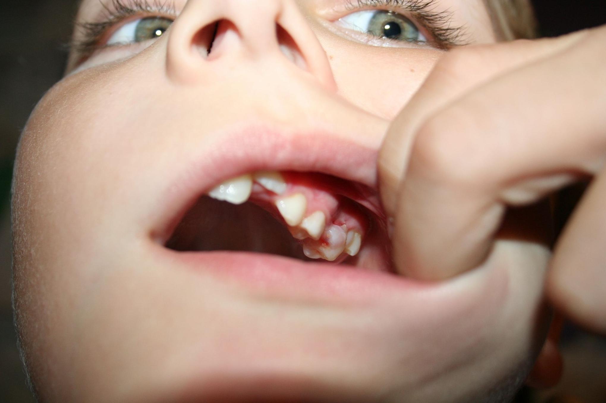 Ortodoncia infantil 