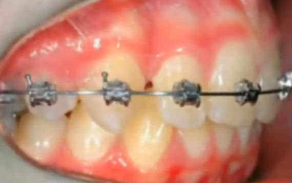 Foto 4 de Dentistas en  | Grupo ClÃ­nico Dental       Dr. Borrega