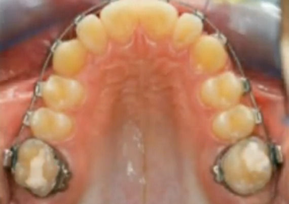 Foto 5 de Dentistas en  | Grupo ClÃ­nico Dental       Dr. Borrega
