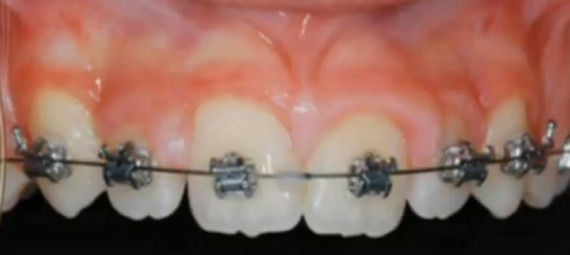 Foto 3 de Dentistas en  | Grupo ClÃ­nico Dental       Dr. Borrega