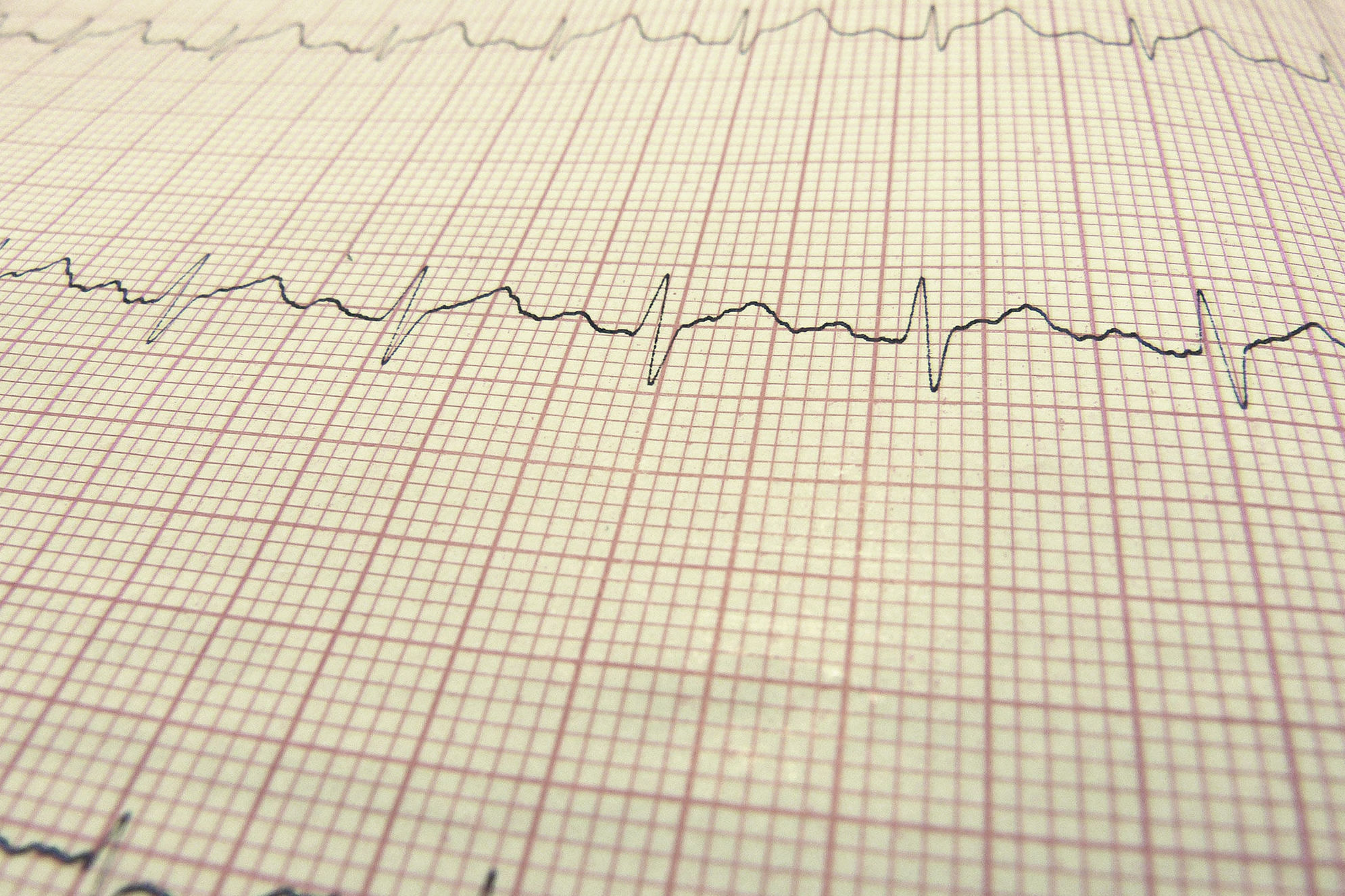 Electrocardiograma: Servicios de Vetalliance Reus Clínica Veterinaria Electrocardiograma: Servicios de Vetalliance Reus Clínica Veterinaria