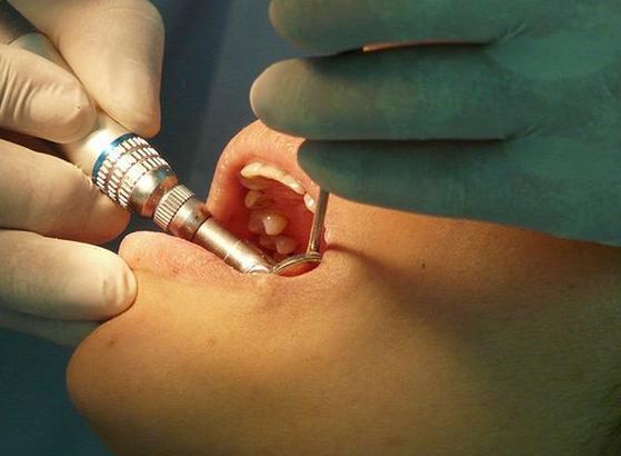 Implantes: Tratamientos  de Clínica Dental Moreaga - Dra. Daniele