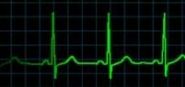 Electrocardiograma: Productos y servicios de Veterinario El Puertito Electrocardiograma: Productos y servicios de Veterinario El Puertito