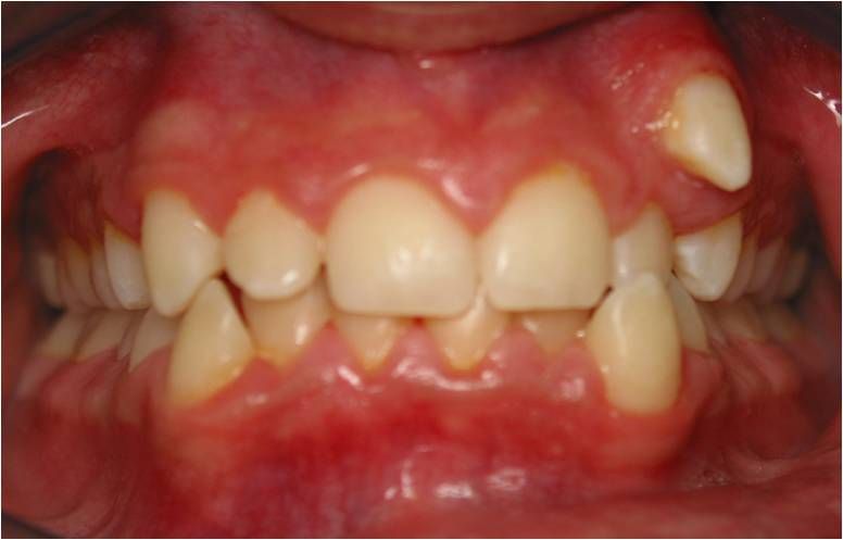 Ortodoncia: Tratamientos de Centro Odontológico La Eliana Ortodoncia: Tratamientos de Centro Odontológico La Eliana