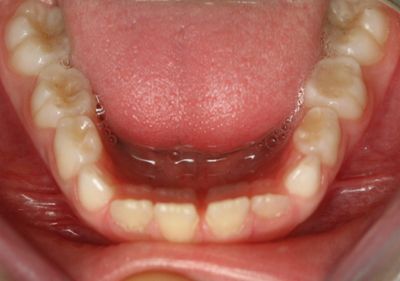 Caso 2: Tratamientos de Centro Odontológico La Eliana Caso 2: Tratamientos de Centro Odontológico La Eliana