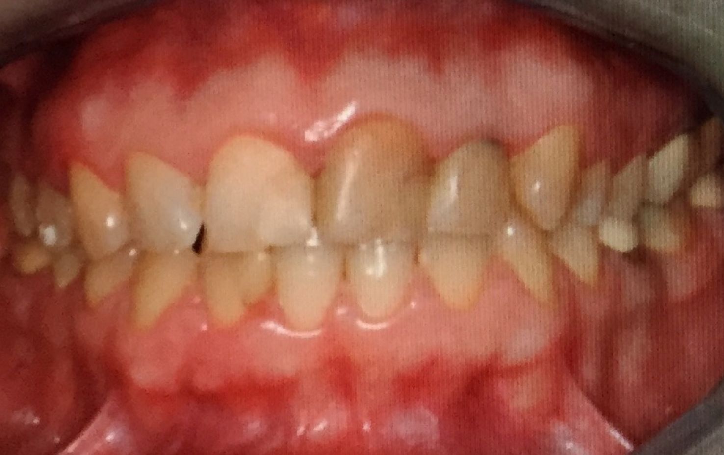 Caso específico: Tratamientos de Centro Odontológico La Eliana Caso específico: Tratamientos de Centro Odontológico La Eliana