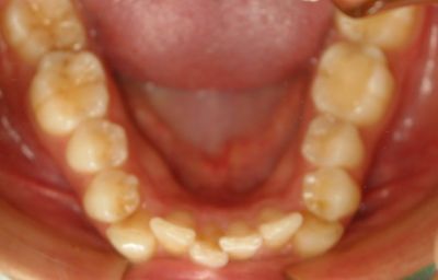 Caso 1: Tratamientos de Centro Odontológico La Eliana Caso 1: Tratamientos de Centro Odontológico La Eliana