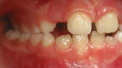 Caso 2: Tratamientos de Centro Odontológico La Eliana Caso 2: Tratamientos de Centro Odontológico La Eliana