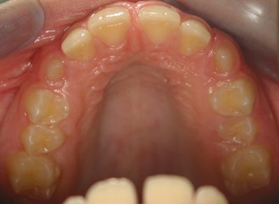Caso 3: Tratamientos de Centro Odontológico La Eliana Caso 3: Tratamientos de Centro Odontológico La Eliana