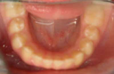 Caso 3: Tratamientos de Centro Odontológico La Eliana Caso 3: Tratamientos de Centro Odontológico La Eliana