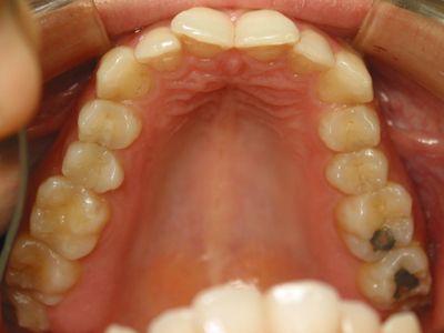 Caso 1: Tratamientos de Centro Odontológico La Eliana Caso 1: Tratamientos de Centro Odontológico La Eliana