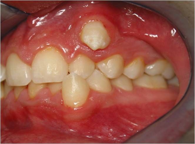 Ortodoncia: Tratamientos de Centro Odontológico La Eliana Ortodoncia: Tratamientos de Centro Odontológico La Eliana