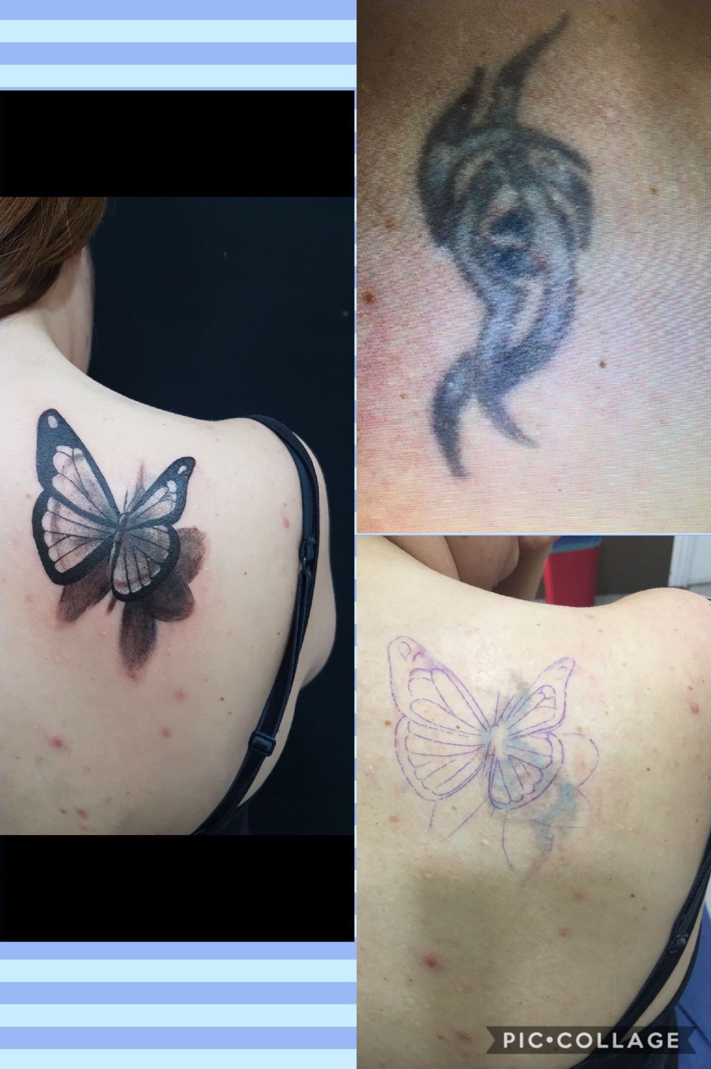 eliminación de tatuajes zarzaquemada eliminación de tatuajes zarzaquemada