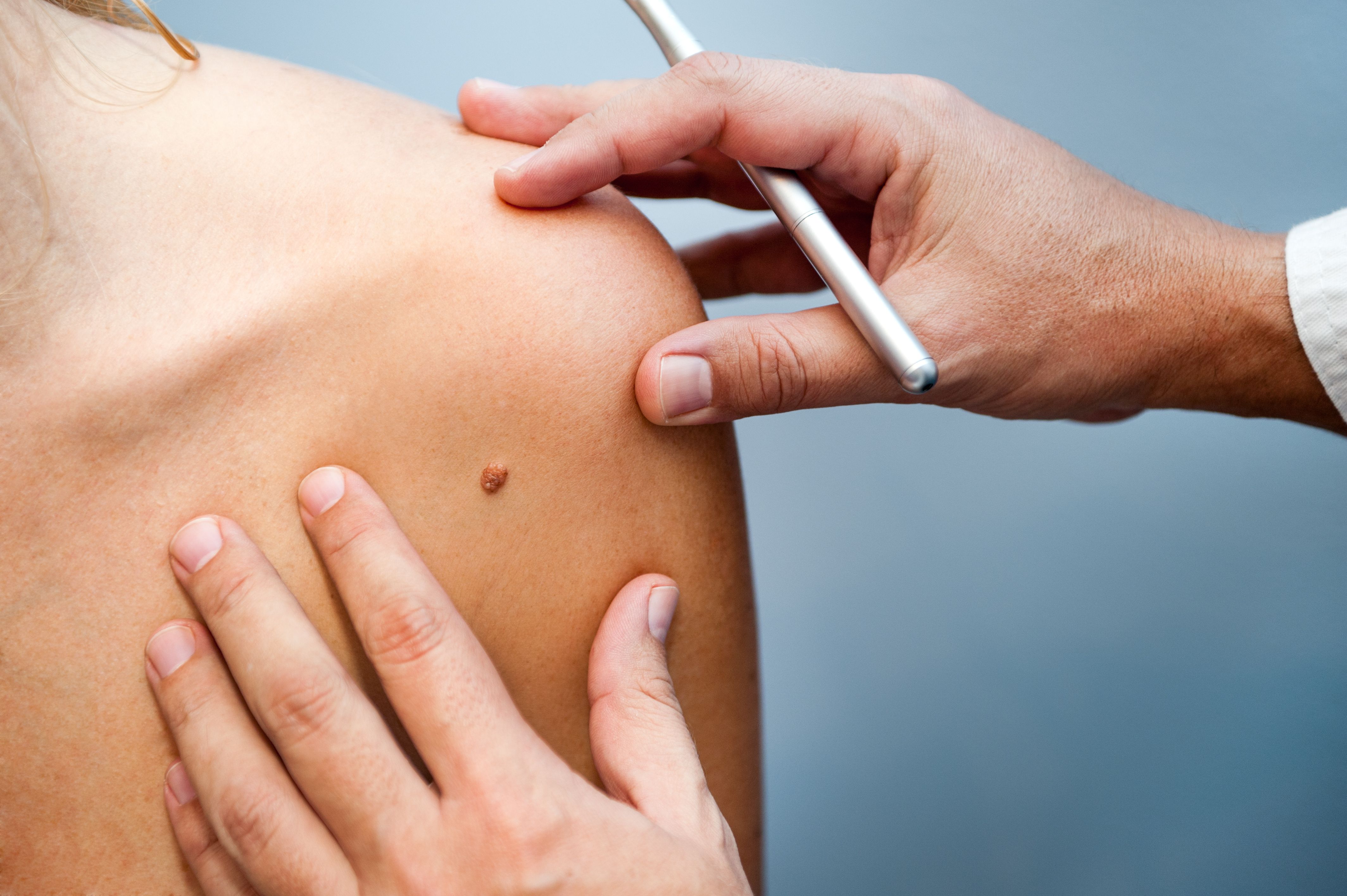 Dermatología: ESPECIALIDADES de Policlínica Centrosalud Dermatología: ESPECIALIDADES de Policlínica Centrosalud
