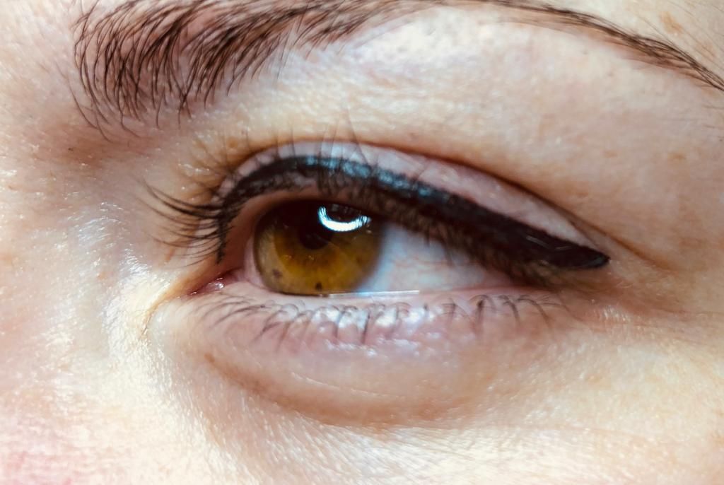 Micropigmentación Barcelona: Patologías y tratamientos de Centro Dermatológico Dr. Javier Bassas Micropigmentación Barcelona: Patologías y tratamientos de Centro Dermatológico Dr. Javier Bassas