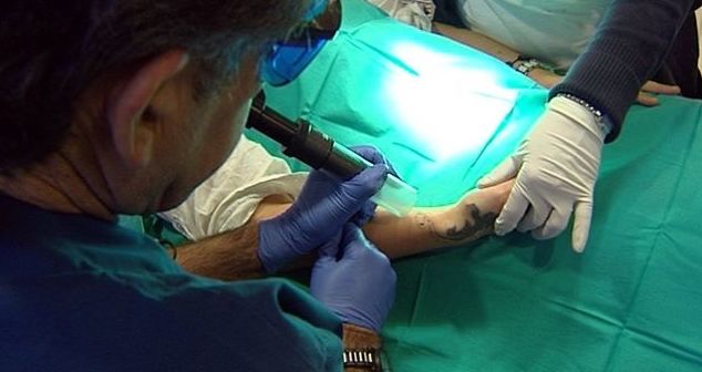 Eliminar tatuajes Barcelona Eliminar tatuajes Barcelona