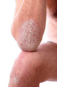 Dermatología Barcelona Dermatología Barcelona