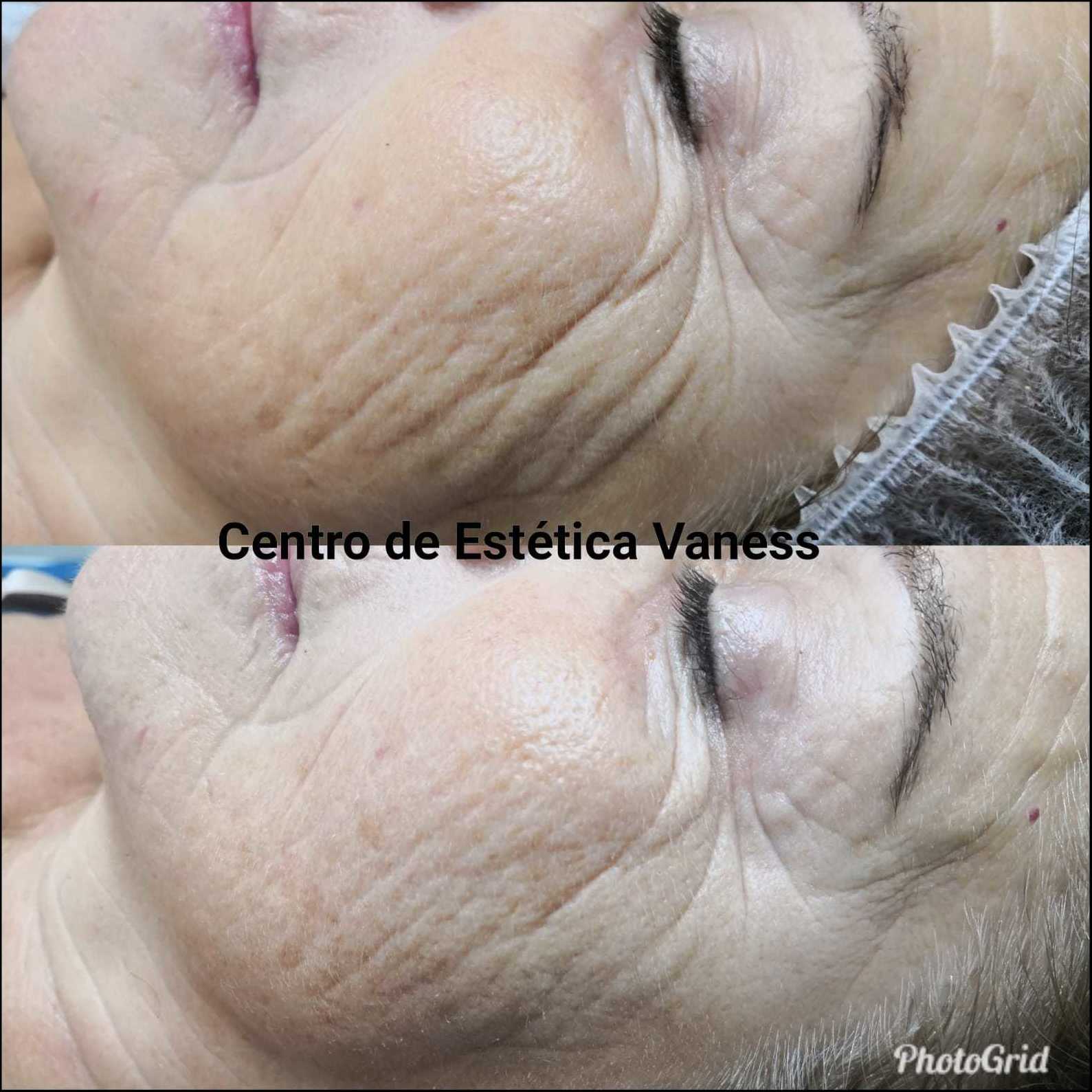 Beoxy Facial: Productos y Servicios de Centro de Estética Vaness Beoxy Facial: Productos y Servicios de Centro de Estética Vaness