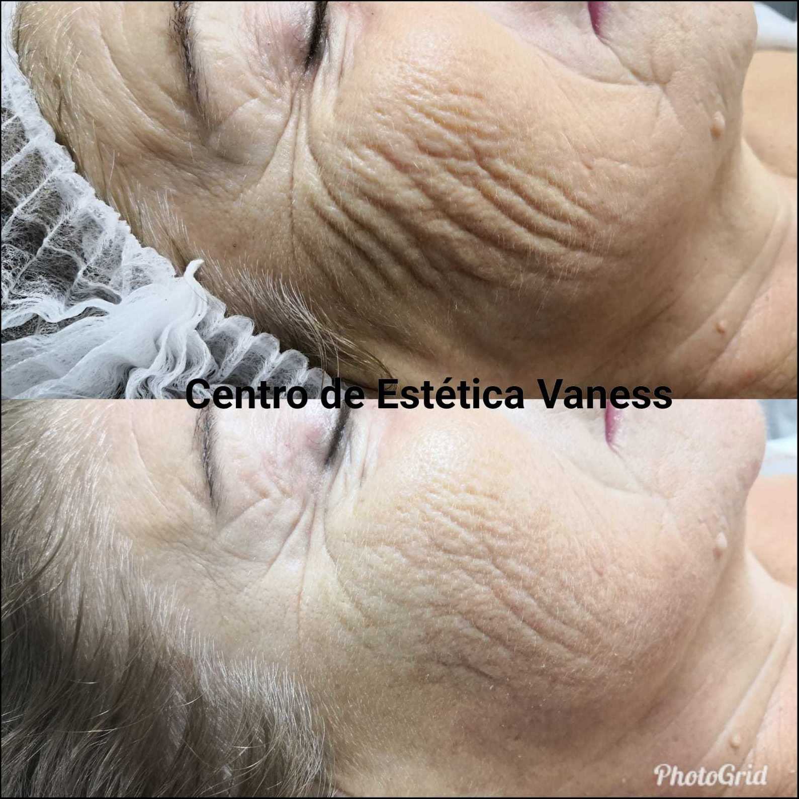 Beoxy Facial: Productos y Servicios de Centro de Estética Vaness Beoxy Facial: Productos y Servicios de Centro de Estética Vaness