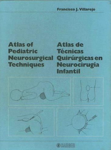 Atlas de Técnicas Quirúrgicas en Neurocirugía Infantil: Especialidades y publicaciones de Doctor Villarejo Atlas de Técnicas Quirúrgicas en Neurocirugía Infantil: Especialidades y publicaciones de Doctor Villarejo